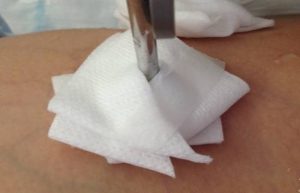 Gauze being secured around a pin with tape