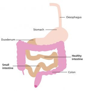Illustration of healthy intestine, stomach and bowel