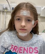 Photograph of child with sensors stuck on their face