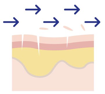 Illustration of cross-section of skin, muscle and bone, with arrows showing how the skin is rubbed against a surface and damages the skin