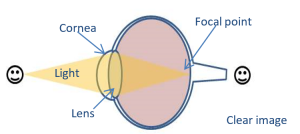 Diagram of normal eye, which can create a clear image