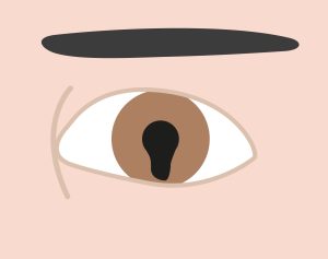 Illustration of coloboma in eye