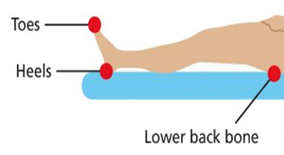 picture of a leg showing where pressure sores may develop